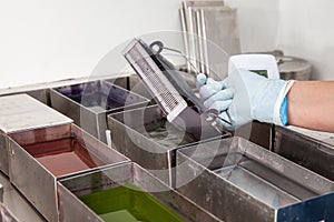 Scientist staining microscope slides for cytology studies in the laboratory