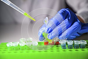 Scientist taking out green solution in eppendorf tube and pipette for biomedical research with tube rack on a white bench