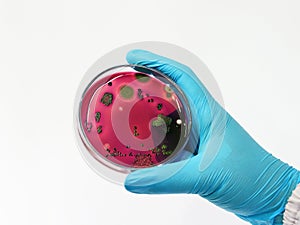 Scientist test Escherichia coli E.coli culture with Eosin Methylene Blue EMB Agar in Petri dish show the metallic green sheen photo