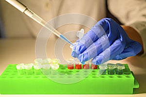 Scientist working with blue solution in eppendorf tube and pipette for biomedical research with tube rack on a white bench