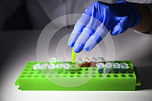 Scientist working with green colour solution in eppendorf tube for biomedical research with tube rack on a white bench