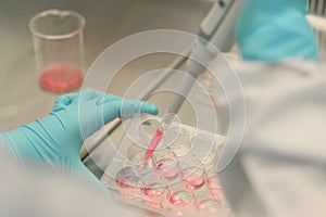 Scientist working in laboratory, microbiologis`s hand with gloves holding a pipette, preparing culture media for cell culture