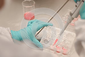 Scientist working in laboratory, microbiologis`s hand with gloves holding a pipette, preparing culture media for cell culture