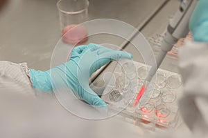 Scientist working in laboratory, microbiologis`s hand with gloves holding a pipette, preparing culture media for cell culture