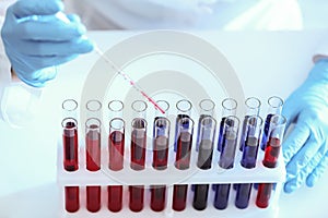 Scientist working with test tubes in laboratory, closeup