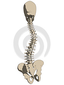 Scoliosis