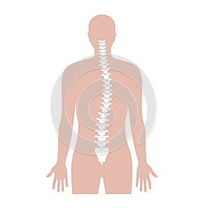 Scoliosis flat vector illustration