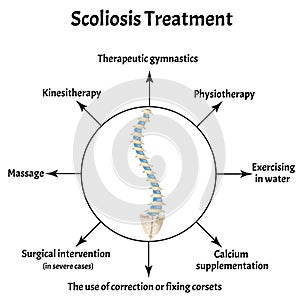 Scoliosis treatment. Spinal curvature, kyphosis, lordosis of the neck, scoliosis, arthrosis. Improper posture and stoop photo