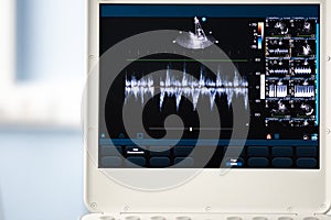 The screen of the apparatus for ultrasound examination showing t