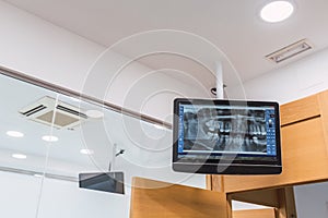 Screen with dental X-rays. Dental office.