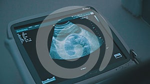 Screen of echo-cardiography machine, ultrasound of abdominal cavity.