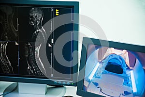 Screen showing the results of the patient`s MRI scan