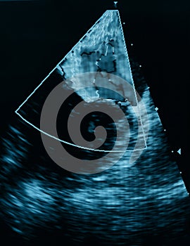 Obrazovka ultrazvuk stroj. diagnostika v zdravotná starostlivosť 