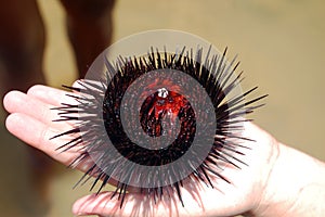 Sea urchin