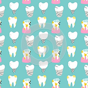 Seamless pattern filled tooth with decayed implant