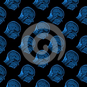 Seamless pattern of MRI scans of sixty years old caucasian female head in sagittal or longitudinal plane - classic blue