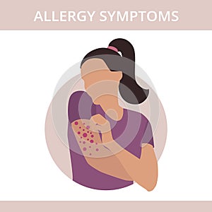 Seasonal allergy. Woman with red skin rash. Woman scratching skin on her hand