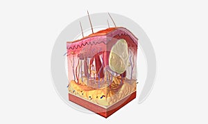 The Sebaceous Cyst Tissue Detail photo