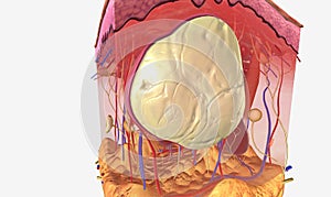 The Sebaceous Cyst Tissue Detail photo