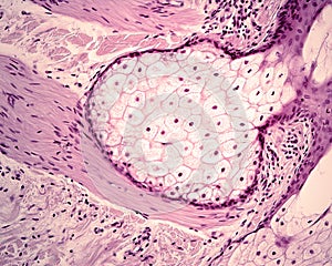 Sebaceous gland. Arrector pili