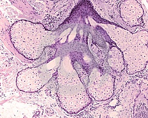 Pilosebaceous unit. Sebaceous gland photo