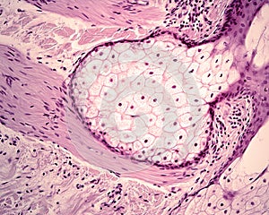 Sebaceous gland. Arrector pili photo