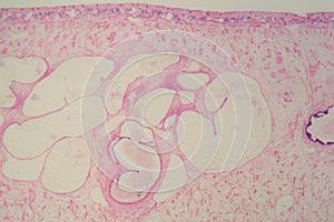 Section of a common liver fluke Fasciola under the microscope
