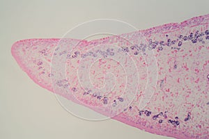 Section of a common liver fluke Fasciola under the microscope