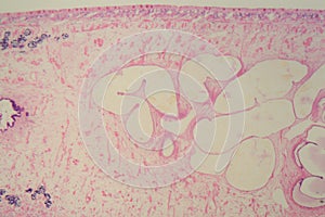 Section of a common liver fluke Fasciola under the microscope