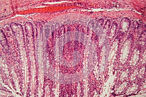 Section of a dog ciliated epithelium