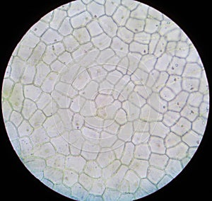 Section--epidermal cells photo