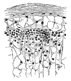 Section of the Lymphatic Gland Showing the Adenoid Reticulumn vintage illustration