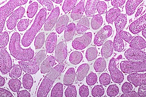 Section of Testis tissue under the microscope .