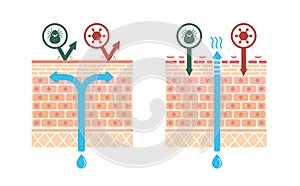 Sectional view of atopic dermatitis and normal skin / Comparative vector illustration no text