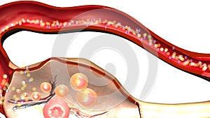 SECTIONAL VIEW OF OVARY