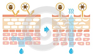 Sectional view of the skin illustration. Comparison of protection effect between healthy skin and wounded skin