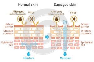 Sectional view of the skin illustration. Comparison of protection effect between healthy skin and wounded skin