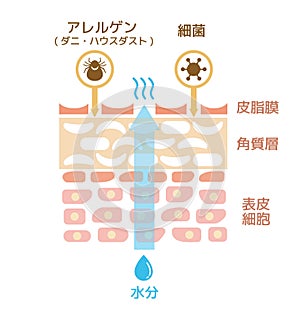 Sectional view of the skin. illustration of damaged skin.