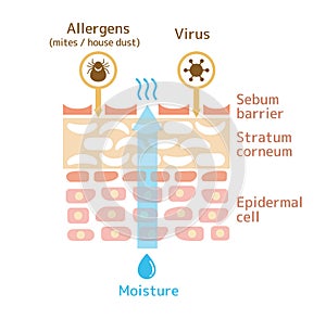 Sectional view of the skin. illustration of damaged skin.