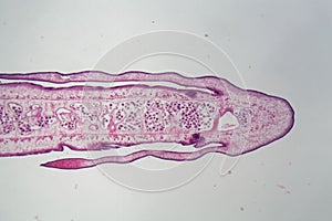 Segment of a tapeworm body Proglottid