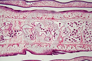 Segment of a tapeworm body Proglottid
