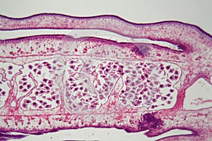 Segment of a tapeworm body Proglottid