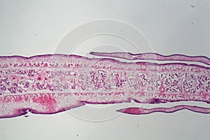 Segment of a tapeworm body Proglottid