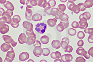 Segmented neutrophil cell in human blood smear