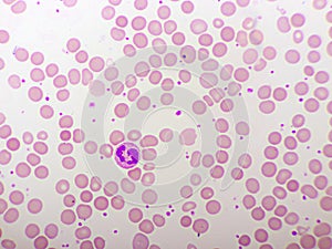 Segmented neutrophil cell in human blood smear