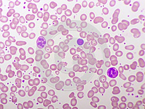 Segmented neutrophil cell in human blood smear