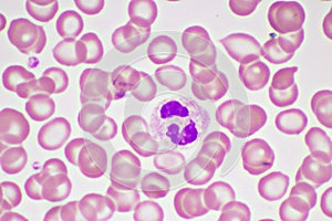 Segmented neutrophil cell in human blood smear photo