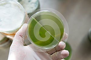 Selection and cultivation of mycelium. Mushroom cultivation around the world