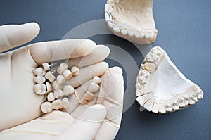 Selection dentures for plaster jaw close-up