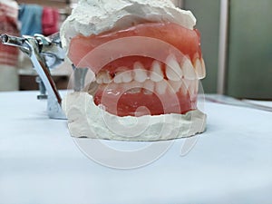 Selective focus on artificial teeths  or denture  fitted  in atrticulater with  a blur background